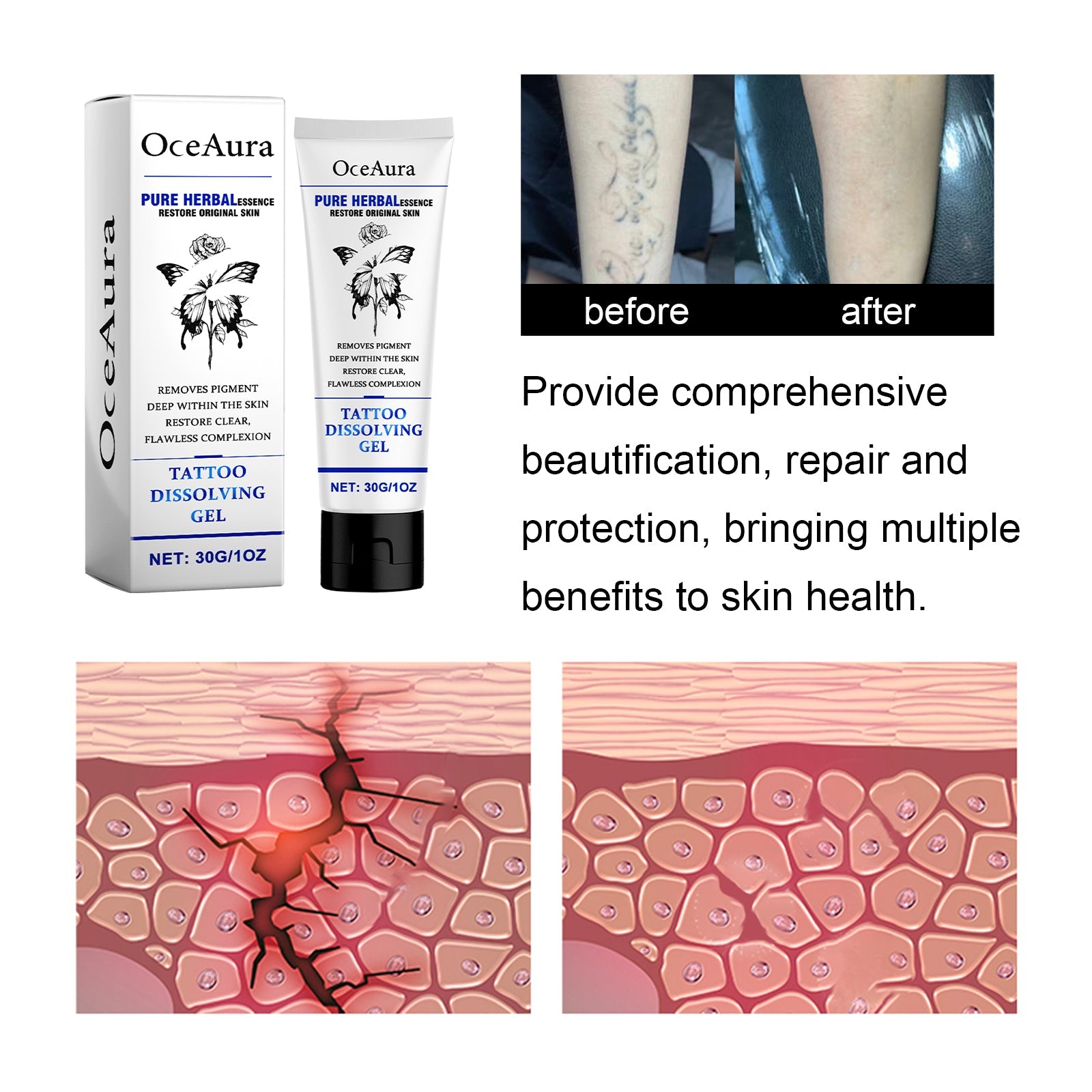 Tattoo Dissolving Gel, Moisturizing Tattoo Skin Repair Skin Tattoo Mark Brightening Care Cream