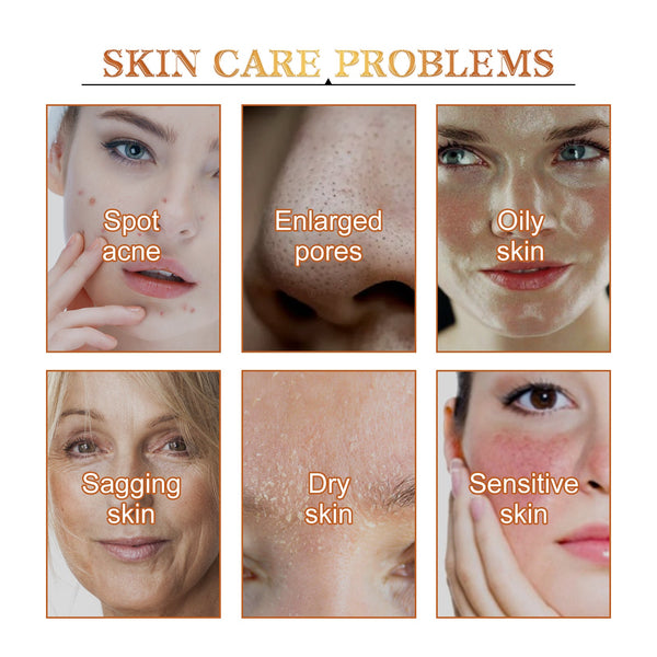 Calendula Peel Mask, Clean Keratin Delicate Pores Brightening Skin And Oil Control Mask