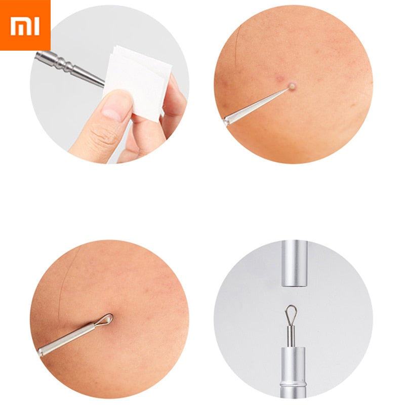 New Xiaomi Youpin Jordan Judy Blackhead Acne Needle Blemish Extractor Remover Stainless Needles Remove Tools Blackhead Remover