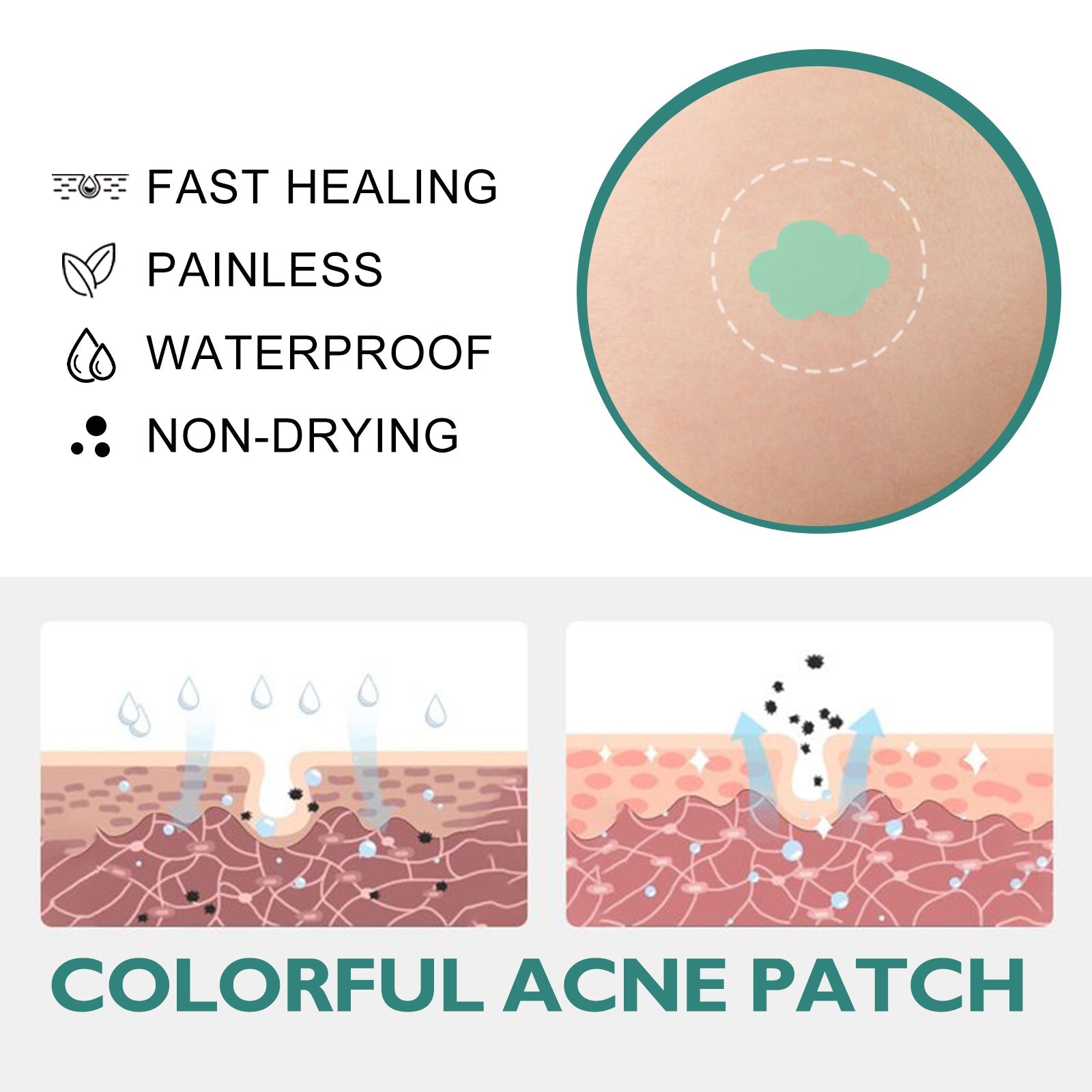 Colorful Acne Patch, Repair Pit Acne Print Smooth Skin Lightening Spot Clear Acne Facial