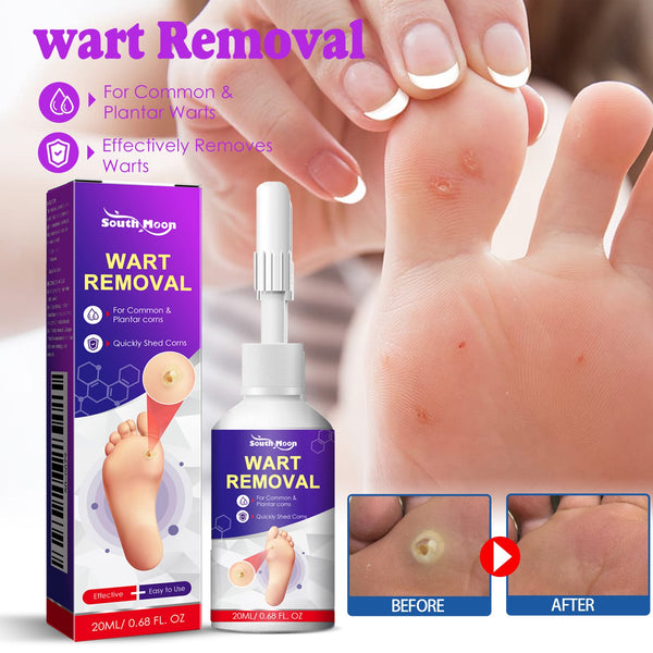 Remove Chicken Eye Lotion Extra Clear Remove Corns Skin Care Chicken Calluses Foot Pad Gram Warts