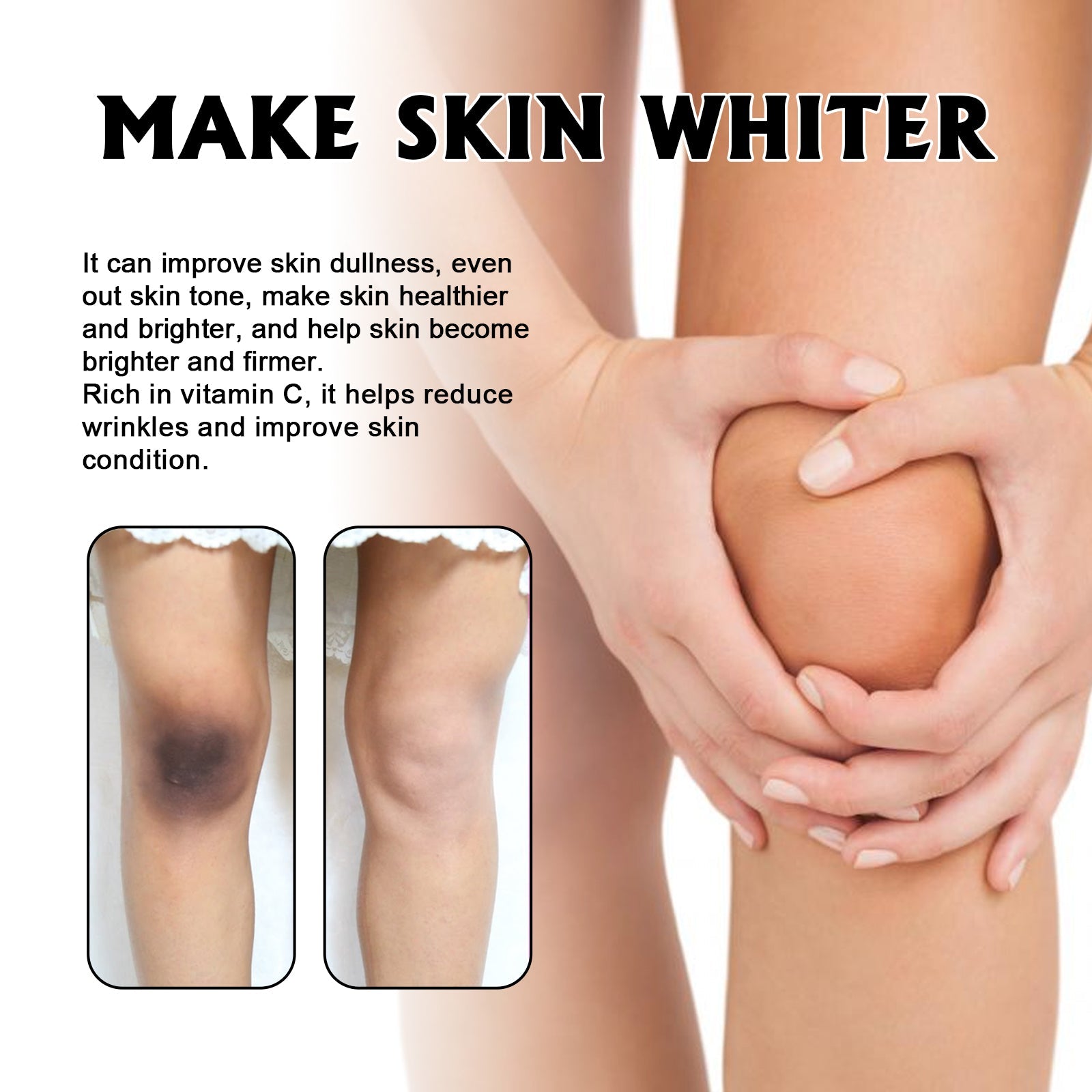 Whitening Skin, Lighten Dull Skin Elbow Black Hydrating, Brightening, Moisturizing And Rejuvenating Essence
