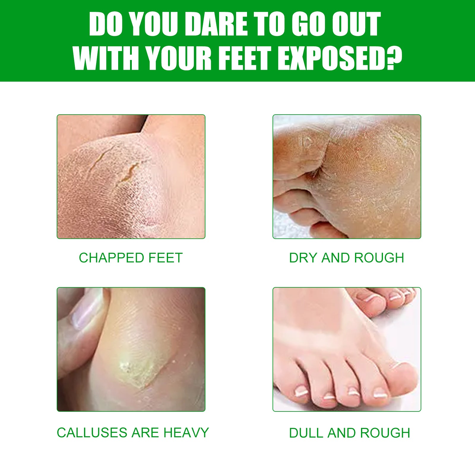 Aloe Vera Foot Mask, Moisturizing Anti-Cracking, Dead Skin Removal, Tender Skin Care Foot Mask