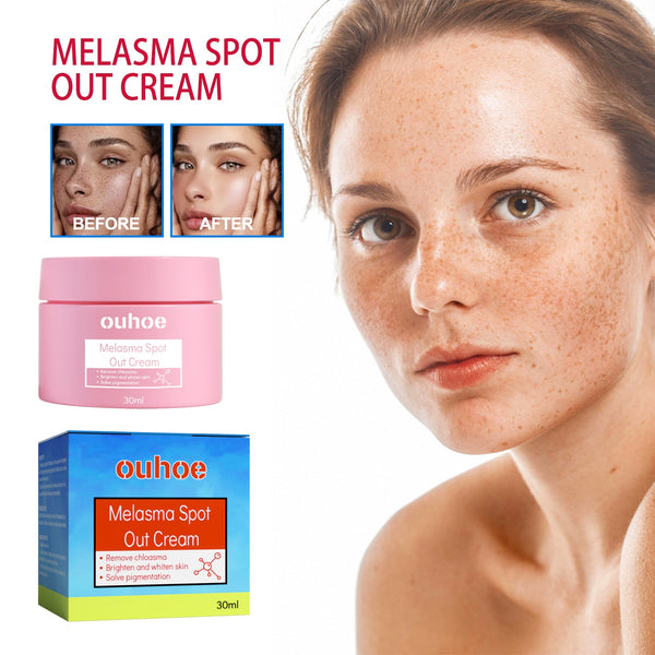 Blemish Cream, Whitening Skin Reduce Melanin Melasma Stains And Hydrating Cream
