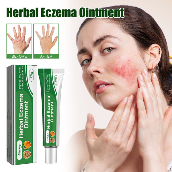 Herbal Eczema Ointment, Relieve Hand And Foot Moss Skin Redness Itchy Skin Repair Ointment