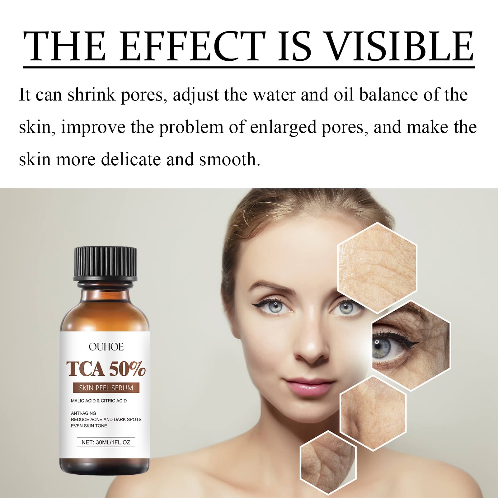 TCA 50 Skin Peel Serum, It Moisturizes Brightens The Firming Skin Fade Wrinkles This Skin Cream