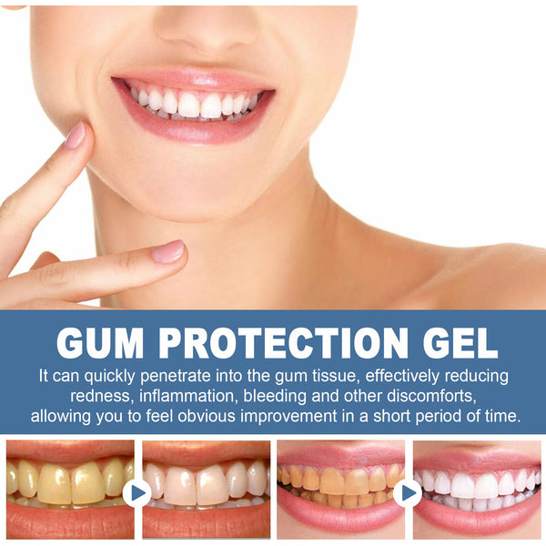 Gum Protection Gel, Teeth Whitening And Whitening Gum Repair Oral Cleaning And Care Dental Pencil