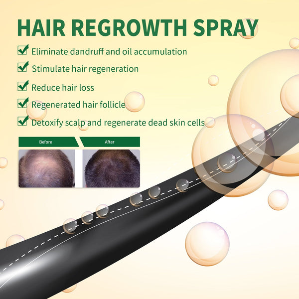Hair Growth Spray, Thickening Preventing Loss And Repairing Hair Follicle Damage Dry And Frizzy Hair Spray