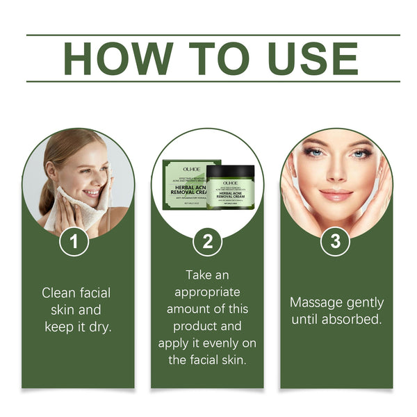 Herbal Acne Cream Hydrates, Moisturizes, Improves Skin, Details Pores, And Lightenes Blemishes