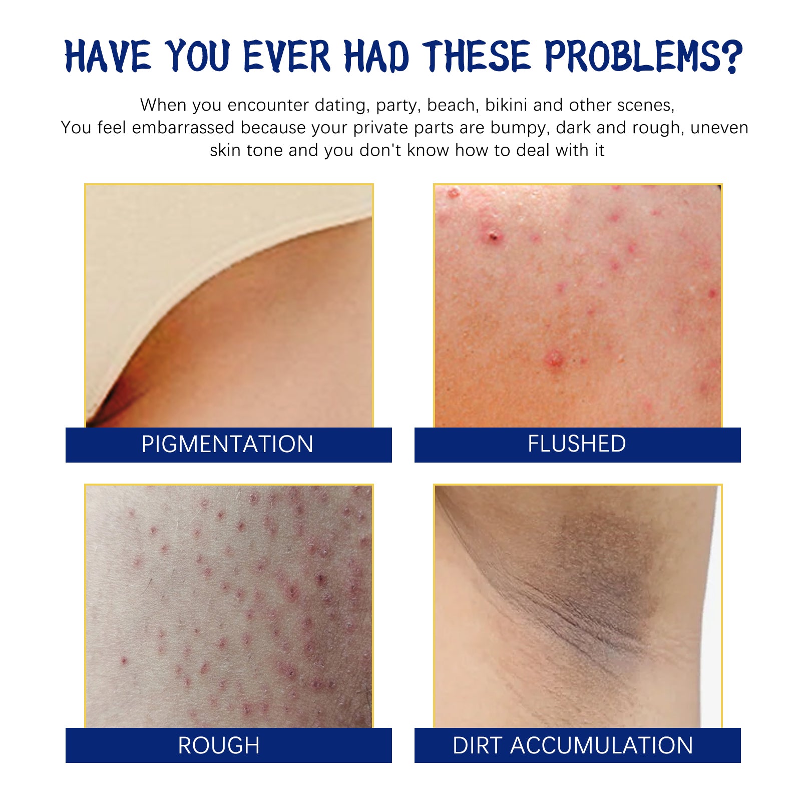 Body Whitening Cream, Lightening Dull Skin Even Skin Tone Moisturizing Skin Beauty Cream