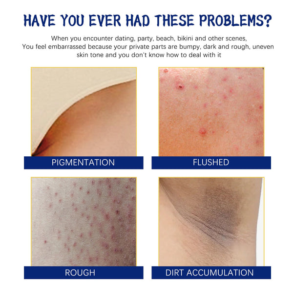 Body Whitening Cream, Lightening Dull Skin Even Skin Tone Moisturizing Skin Beauty Cream