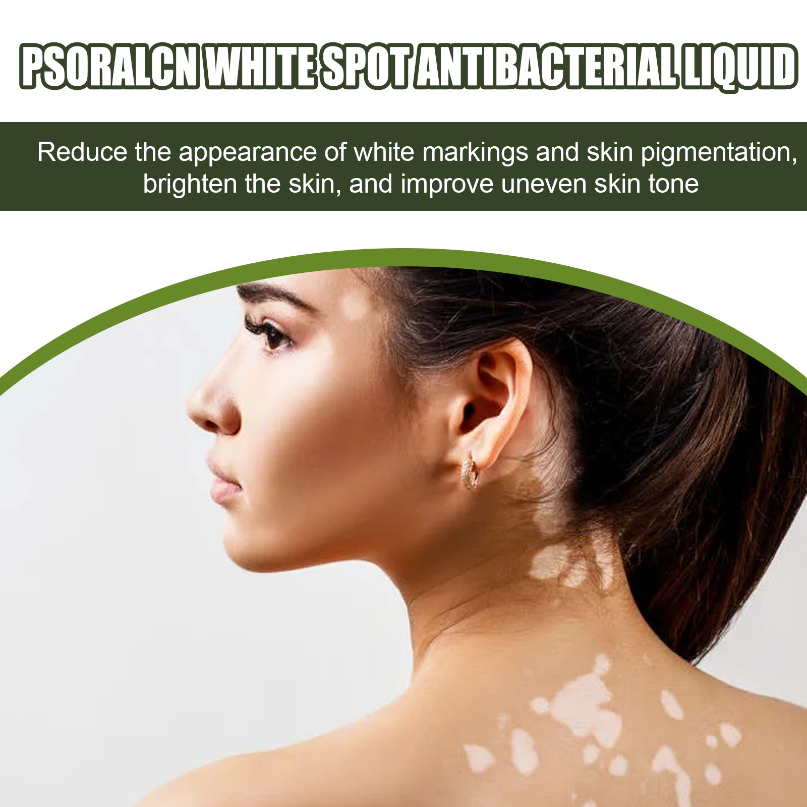 White Spot Purifying Serum For Whitening And Repairing White Spot Spot And Perspiration Spot Skin Moisturizing Serum