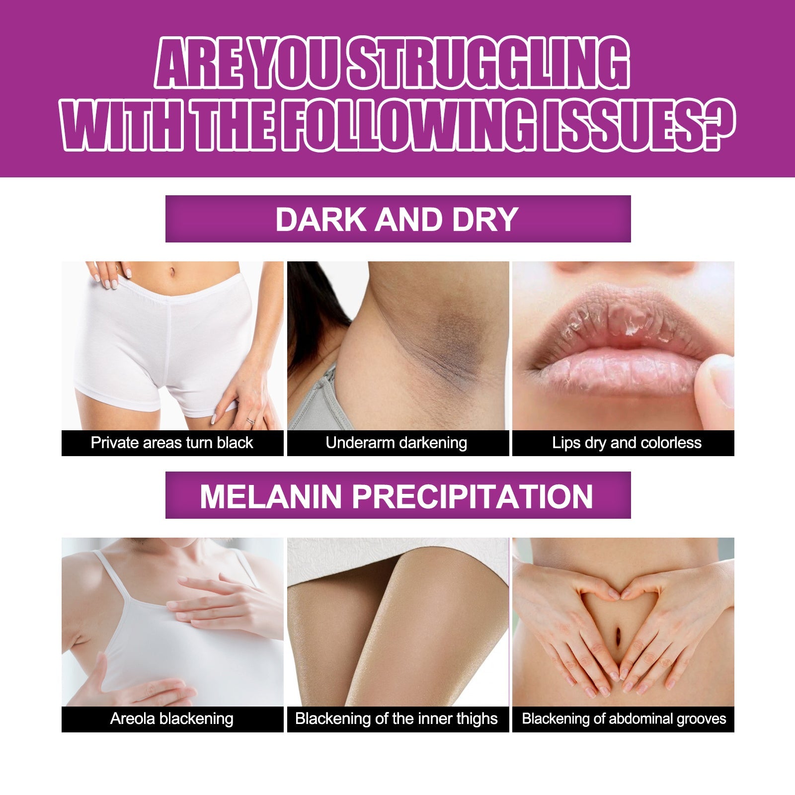 Skin Firming Cream, Brightening Skin Melanin Removal Brightening Skin Moisturizing Cream