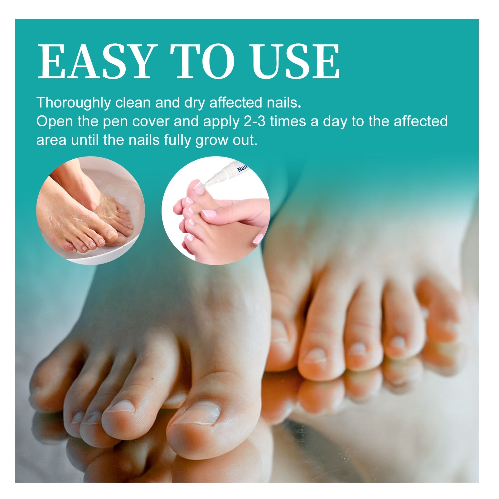 Nail Repair Pen, Repair Hands And Feet Gray Nails Brightening Nails Soft Nails Thickening Nails Moisturizing Care