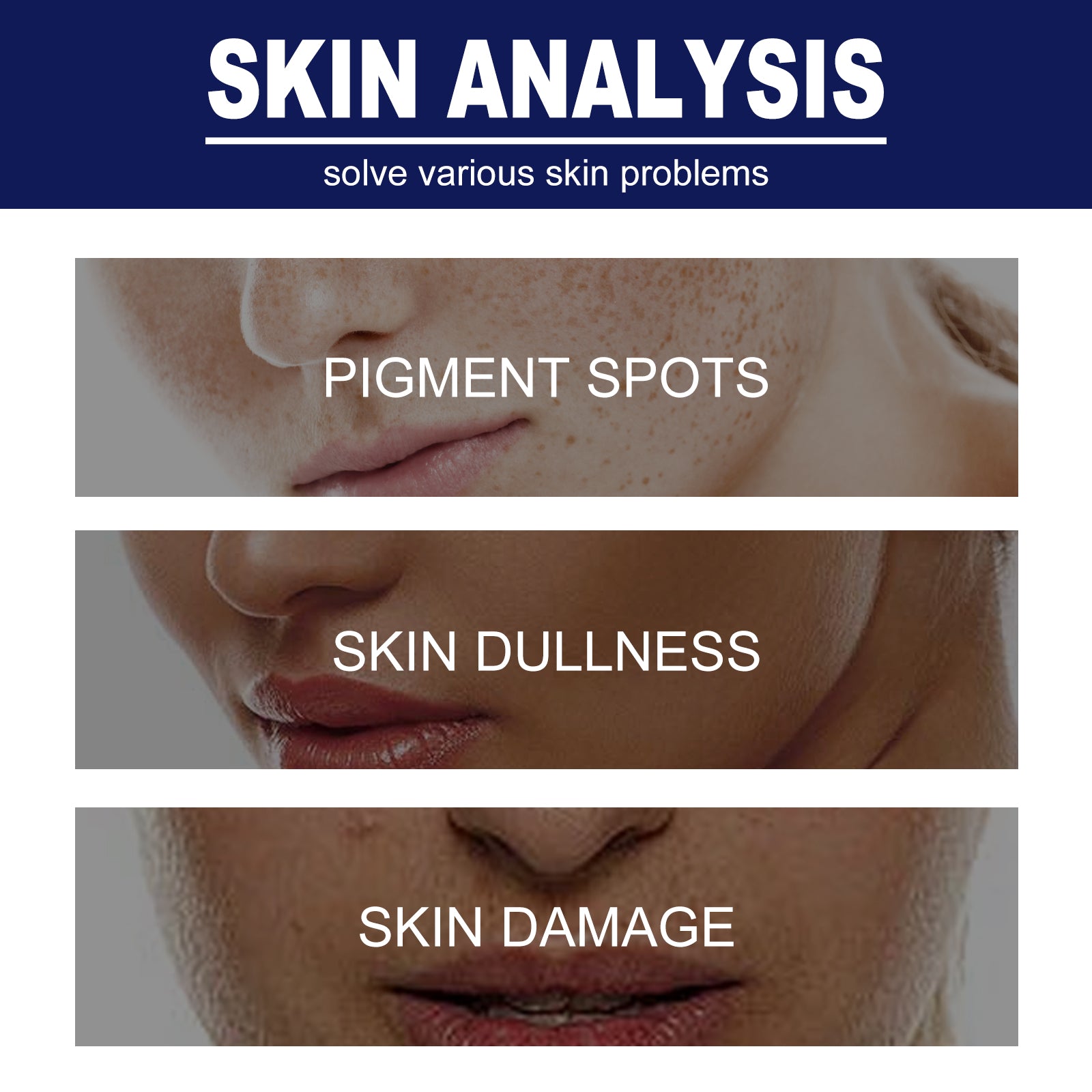 Skin Genesis Spot Whitening Cream, Filling Water To Moisten Soft Delicate Chun White Brighten The Melanin Of Skin Cream