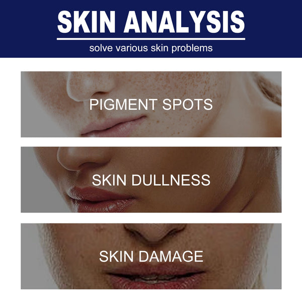 Skin Genesis Spot Whitening Cream, Filling Water To Moisten Soft Delicate Chun White Brighten The Melanin Of Skin Cream