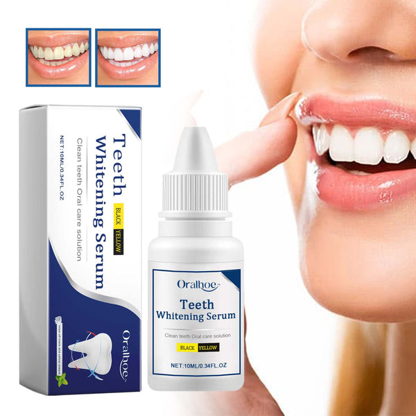 Teeth Whitening Serum, Remove Stains Yellow Dirt Deep Cleaning Whitening Essence