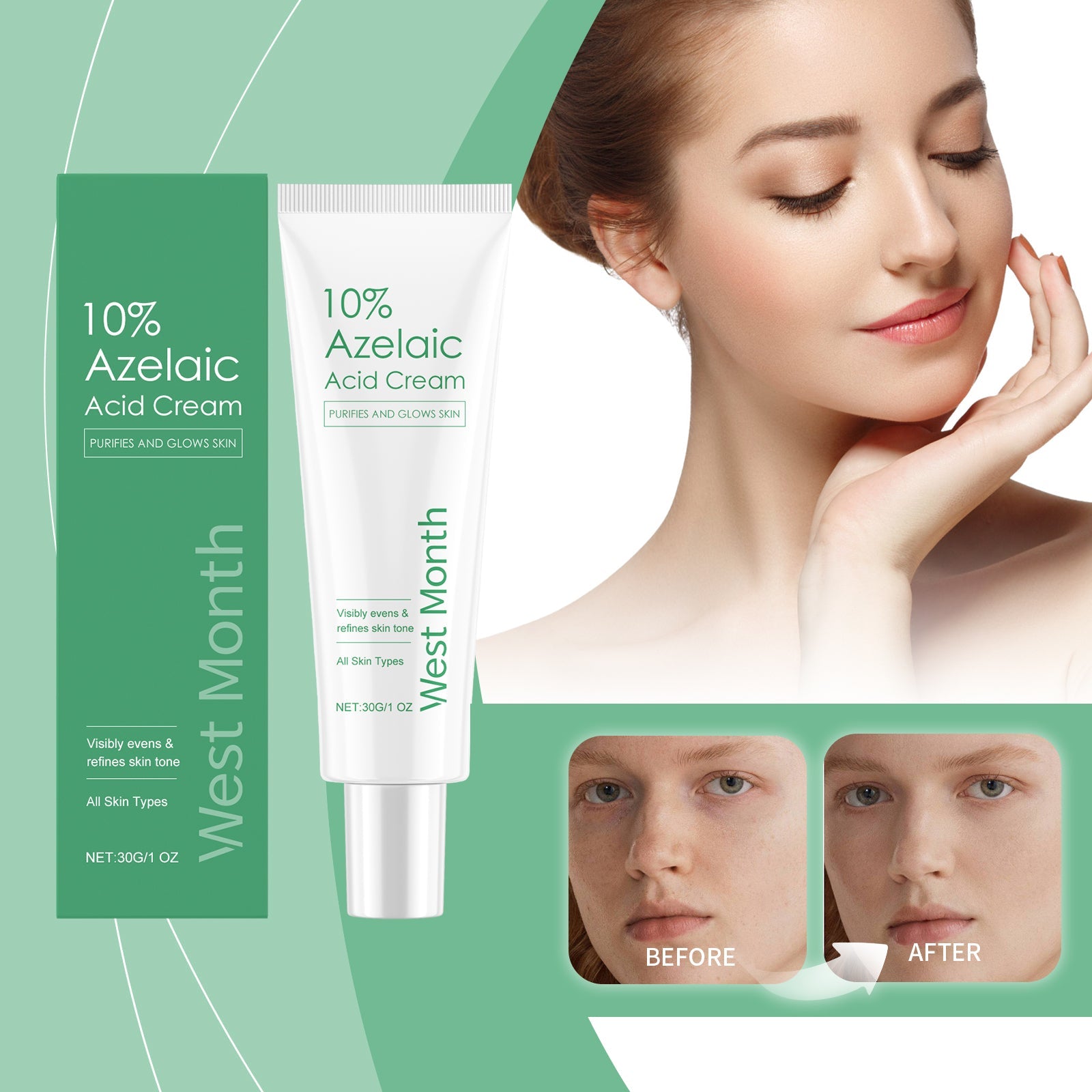 Azelaic Acid Essence Cream, Repair Moisturizing Moisturizing Face Oil Control Moisturizing Mild Refreshing Cream