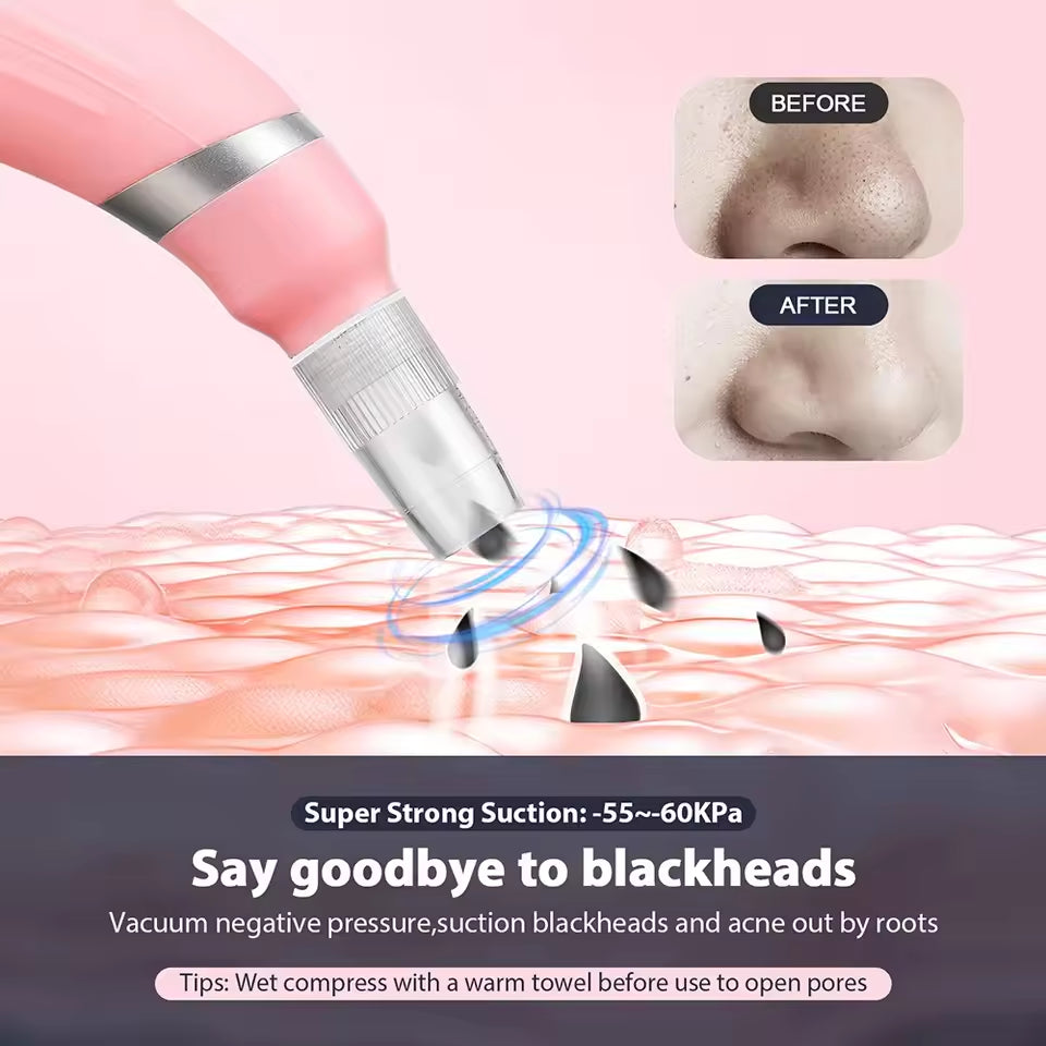 Diamond micro carving pore cleaner removes dead skin with high suction microcrystalline skin rejuvenation beauty device