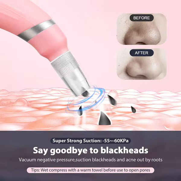 Diamond micro carving pore cleaner removes dead skin with high suction microcrystalline skin rejuvenation beauty device
