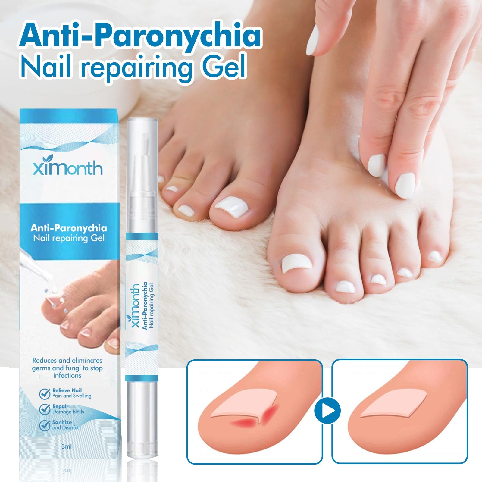 Anti-Paronychia Nail Repairing Gel, Repair Encased Rotten Nails Soft Nails Thickening Pain Relief Cleansing Care