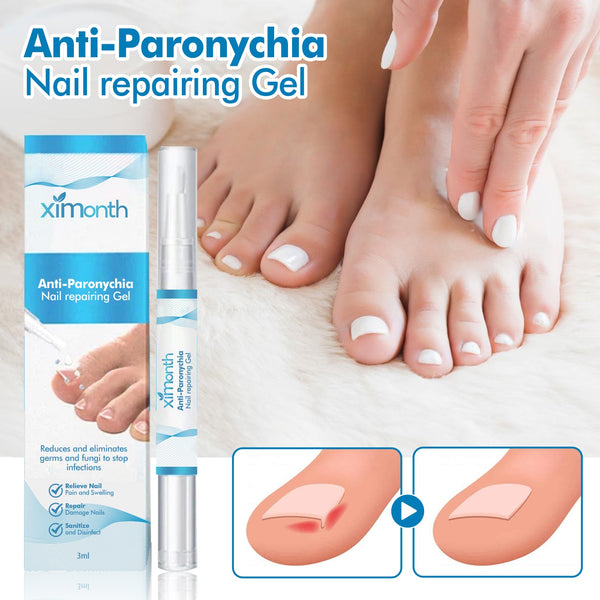Anti-Paronychia Nail Repairing Gel, Repair Encased Rotten Nails Soft Nails Thickening Pain Relief Cleansing Care