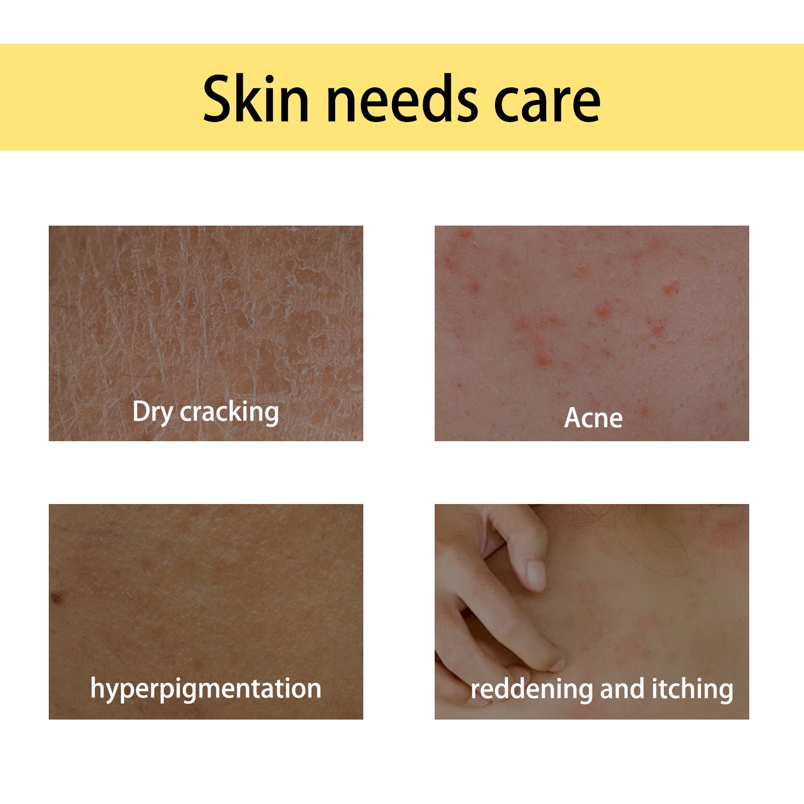 Handcrafted Body Oil, Moisturizing And Hydrating Massage Essential Oil For Soothing Tired Skin