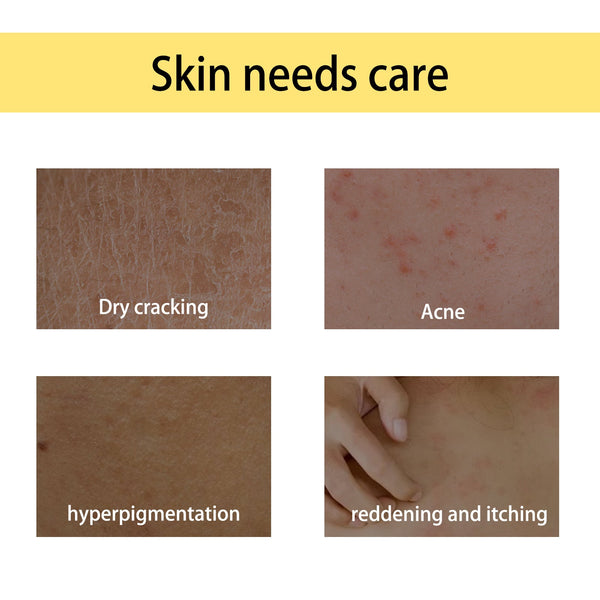 Handcrafted Body Oil, Moisturizing And Hydrating Massage Essential Oil For Soothing Tired Skin