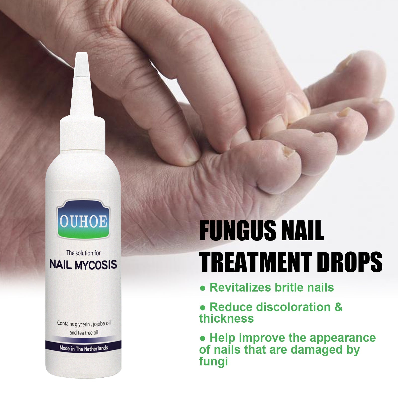 Gray Nail Repair Drops, Repair Hand And Foot Gray Nails Soft And Bright Nail Thickening Nail Care Solution