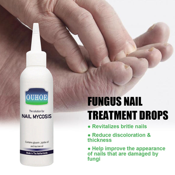 Gray Nail Repair Drops, Repair Hand And Foot Gray Nails Soft And Bright Nail Thickening Nail Care Solution
