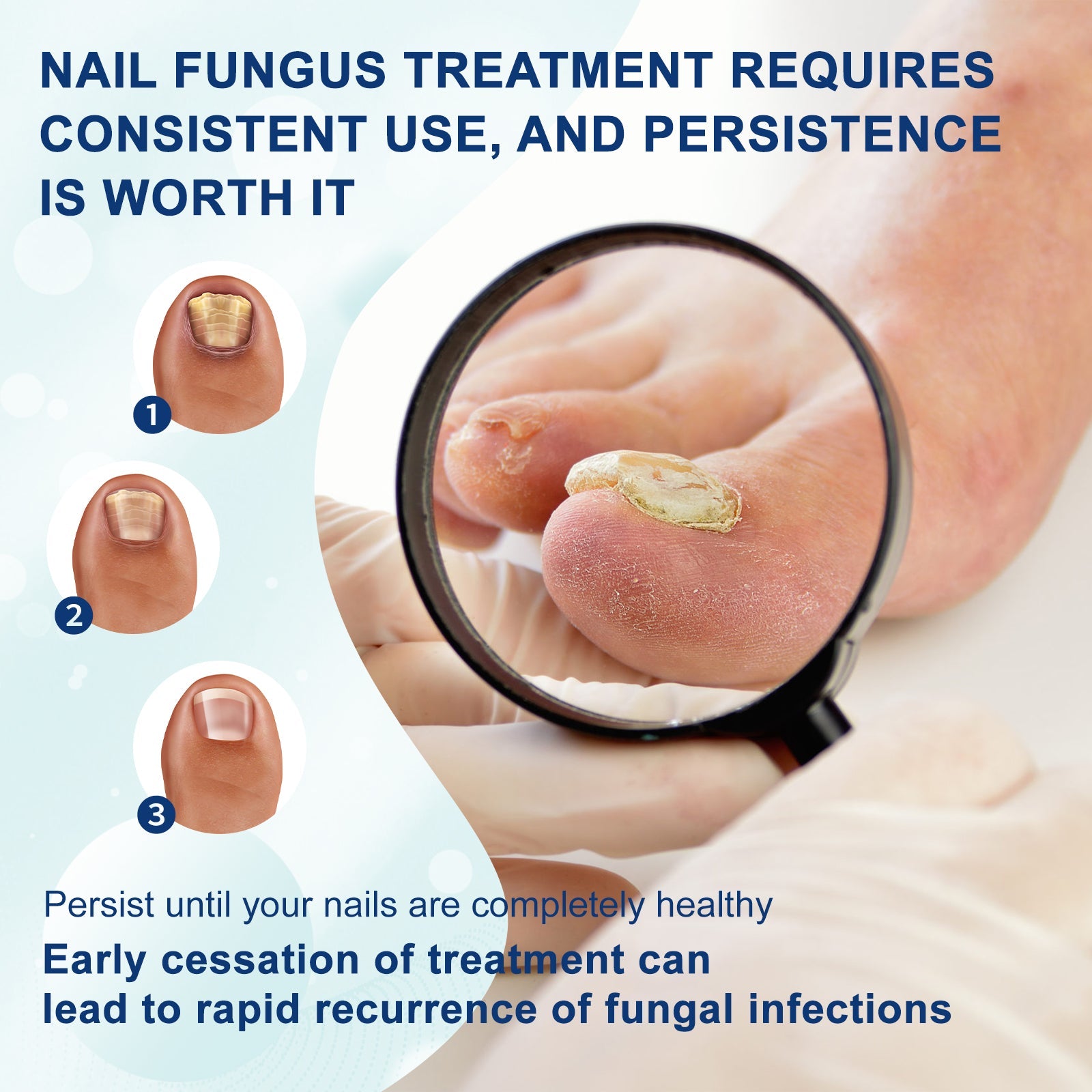 Nail Repair Pen, Repair Hands And Feet Gray Nails Brightening Nails Soft Nails Thickening Nails Moisturizing Care