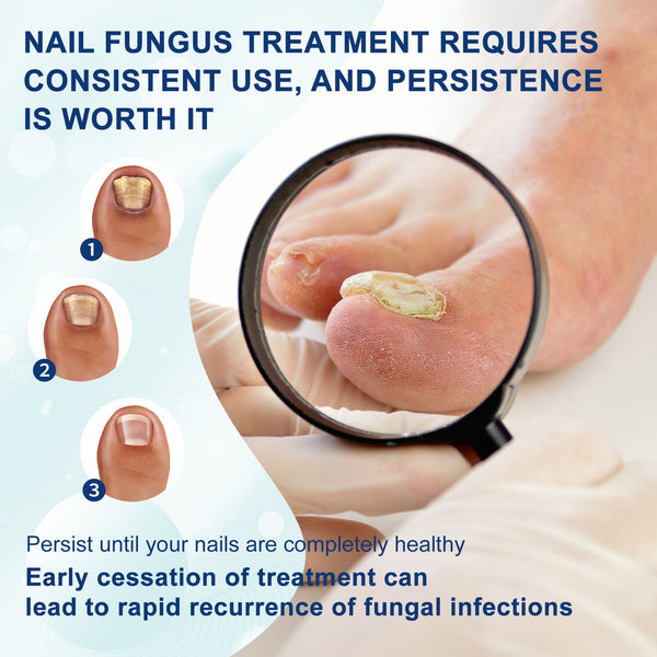 Nail Repair Pen, Repair Hands And Feet Gray Nails Brightening Nails Soft Nails Thickening Nails Moisturizing Care