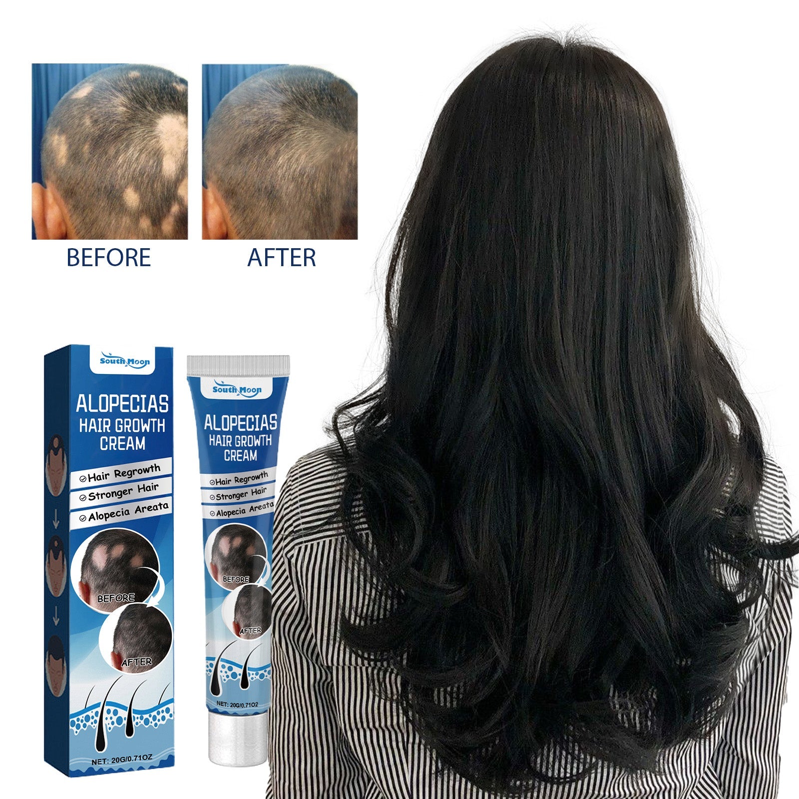 Alopecias Hair Growth Cream, Protect Hair Follicles Strong Moisturizing Thick Hairline Hair