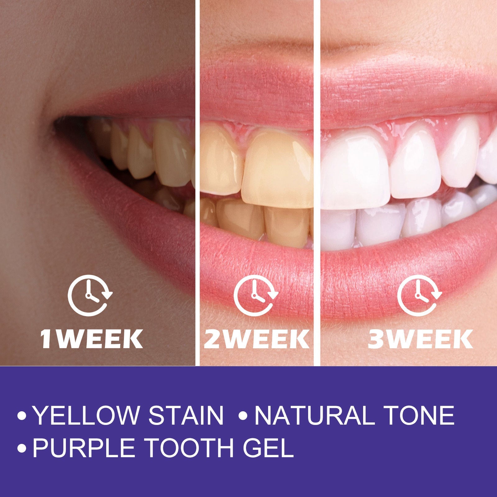 Cleaning Care Stains Yellow Teeth White To Remove Odor And Fresh Mouth