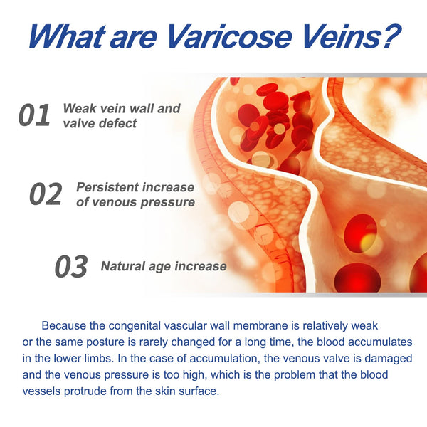 Leg Care Cream Relieves Leg Discomfort Pamper And Moisturize Skin Daily Massage Treatment