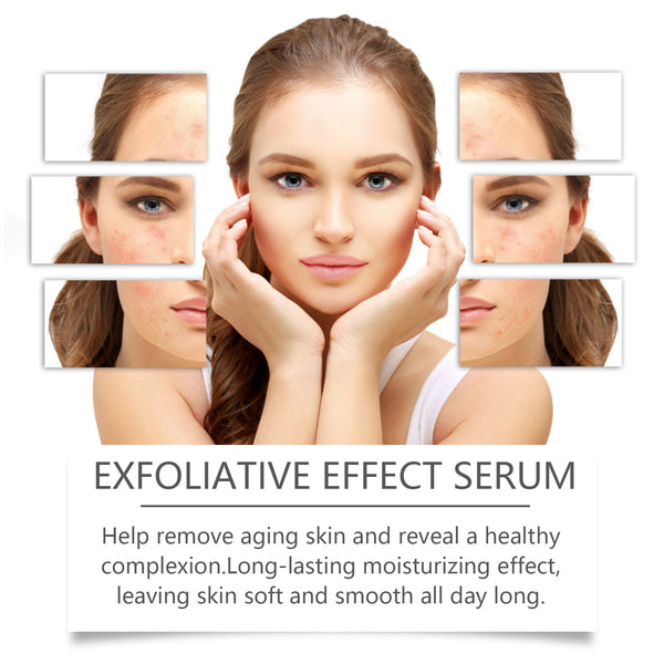 Facial Essence, Moisturizing, Brightening And Moisturizing Facial Skin Exfoliating Gentle Cleansing Repair Essence