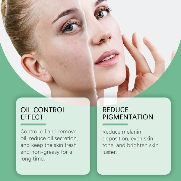 Azelaic Acid Essence Cream, Repair Moisturizing Moisturizing Face Oil Control Moisturizing Mild Refreshing Cream