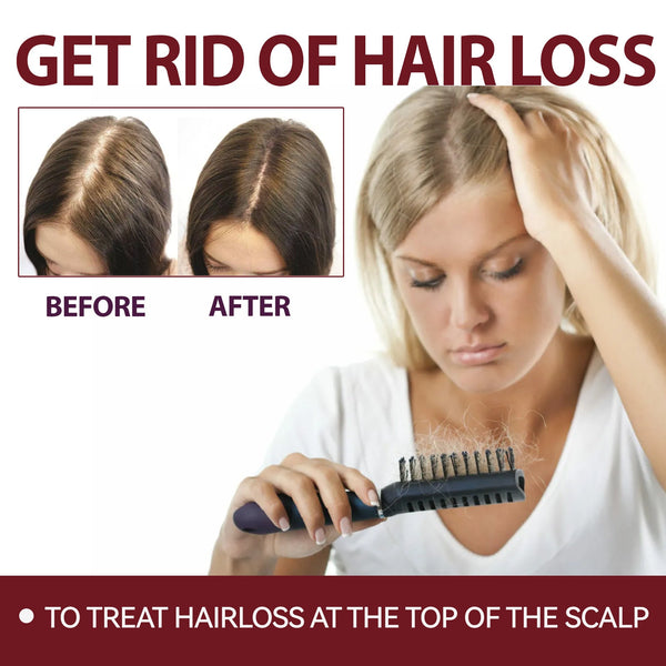 Hair Intensive Essence, Moisturizes Hair Roots, Fast Growing Prevents Loss And Strengthens Hair Care Essence