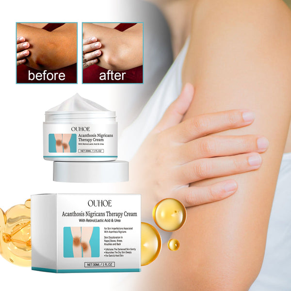 Acanthosis Nigricans Therapy Cream, Repair Dull Skin Lightening Joint Black Moisturizing Whitening Skin Care Cream