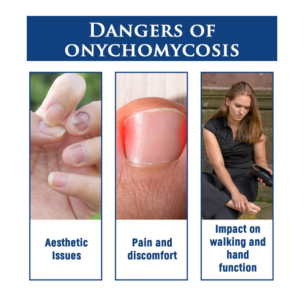 Biological Repair Pencil, Hand, Foot And Nail Care Thickening Repair Soft Nail Insert Nail Bright Nail Nail Pen