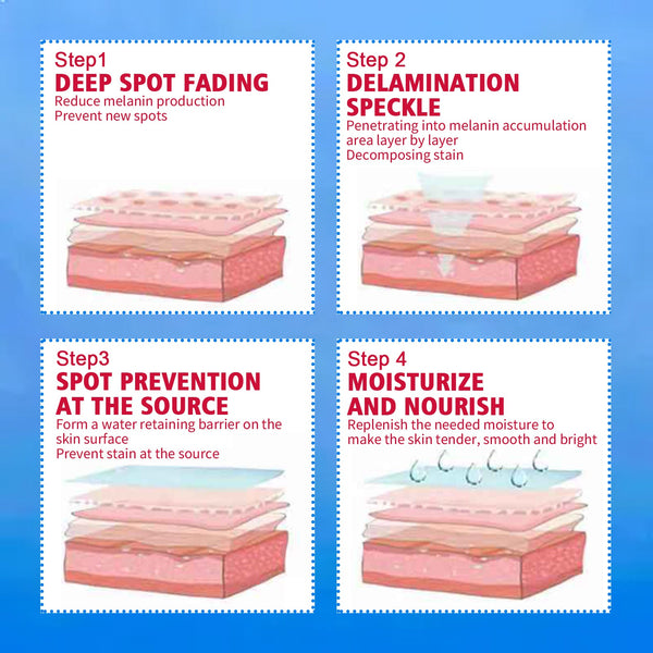 Blemish Cream, Whitening Skin Reduce Melanin Melasma Stains And Hydrating Cream