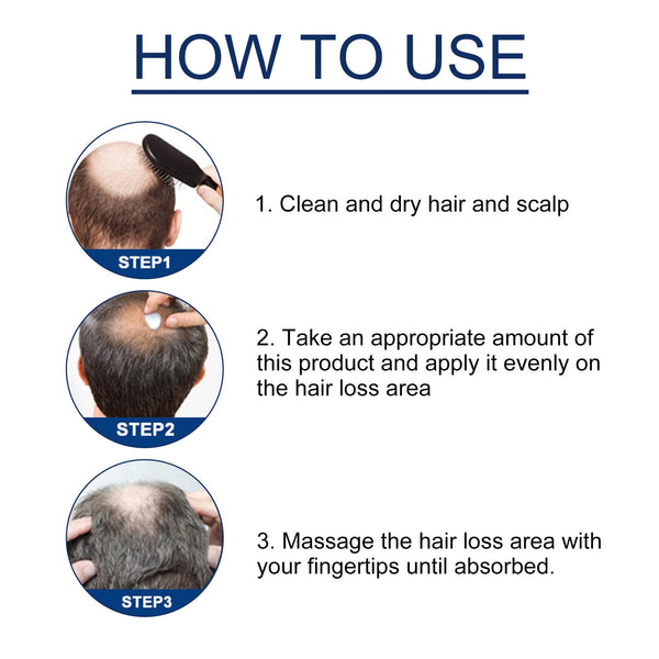 Alopecias Hair Growth Cream, Protect Hair Follicles Strong Moisturizing Thick Hairline Hair