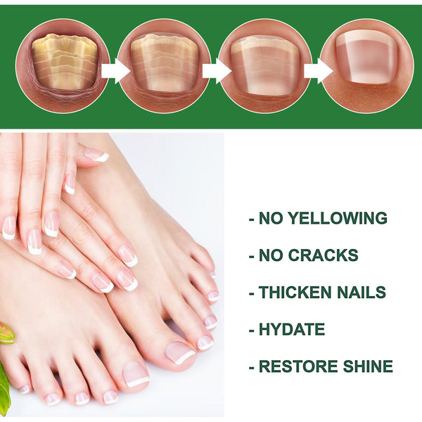 Nail Care Liquid Hand and Foot Nail Care Liquid Daily Cleaning Nail Brightness Soft Nail Moisturizing Nail