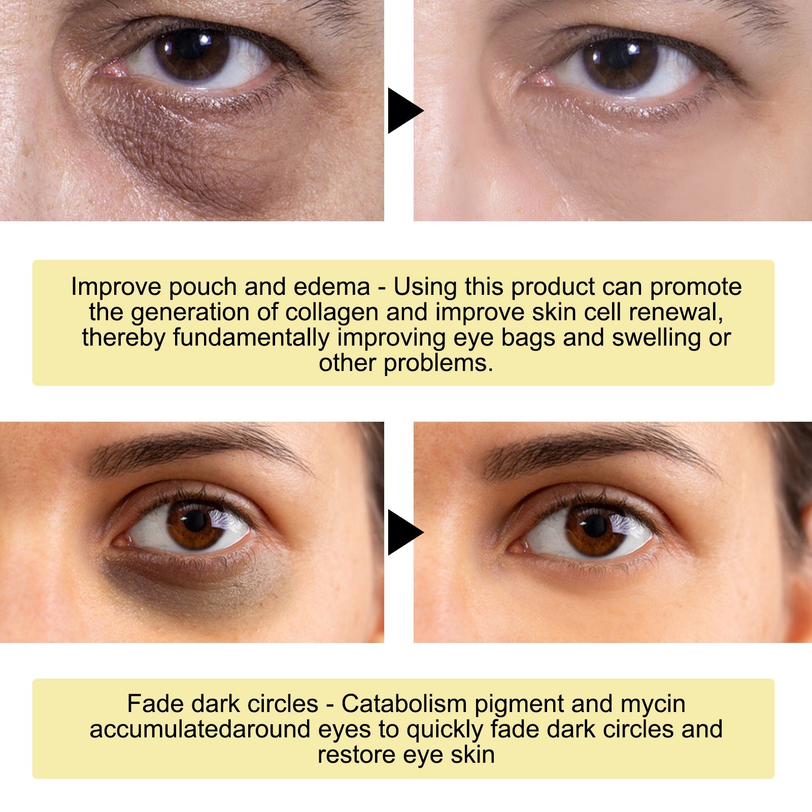 Gold Snail Collagen Eye Mask, Reduces Fine Lines And Puffiness, Hydrates Tightens And Anti-wrinkle Eye Mask