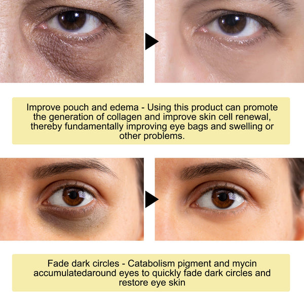 Gold Snail Collagen Eye Mask, Reduces Fine Lines And Puffiness, Hydrates Tightens And Anti-wrinkle Eye Mask