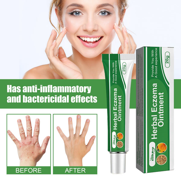Herbal Eczema Ointment, Relieve Hand And Foot Moss Skin Redness Itchy Skin Repair Ointment