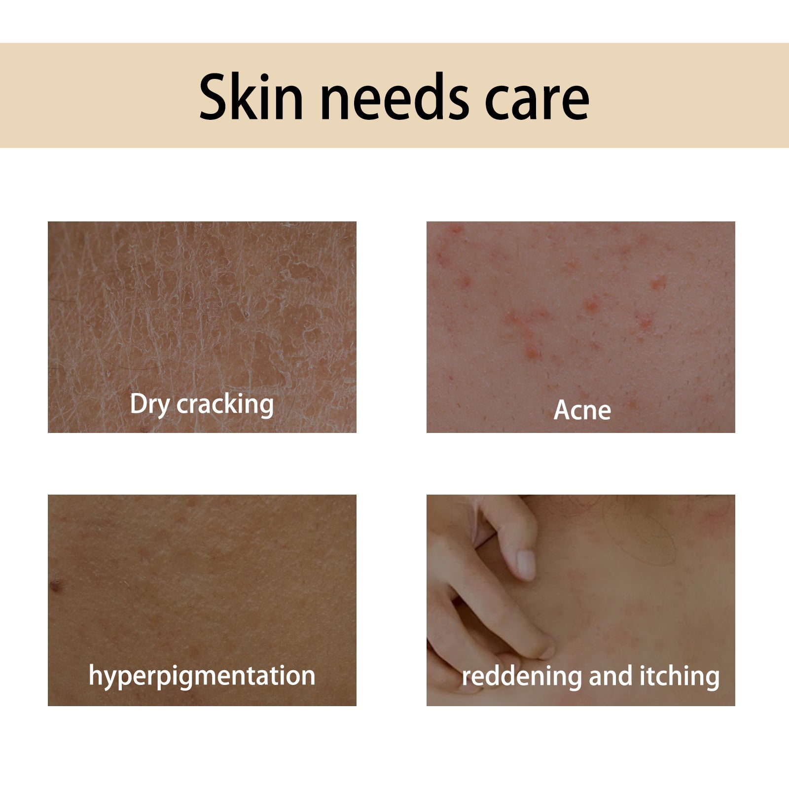 Handcrafted Body Oil, Body Massage Moisturizing Firming And Tender Skin Care Essential Oil