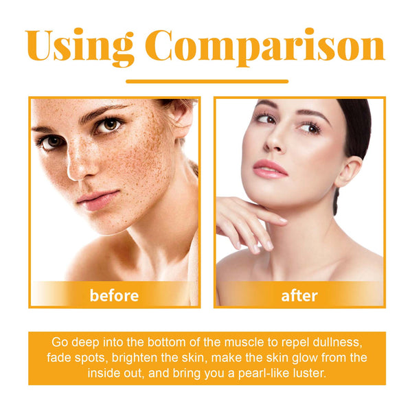 Ouhoe Fruit Acid Facial Body Essence Series, Moisturizing, Moisturizing, Brightening And Firming Skin Essence