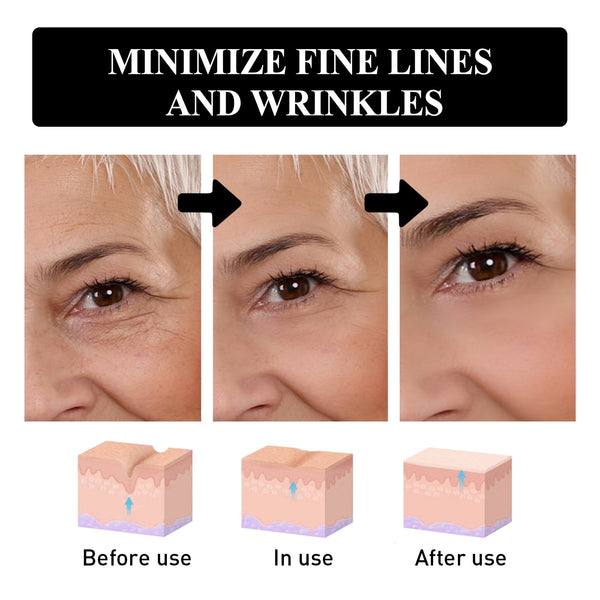 Eye Firming And Lifting Cream Moisturizes And Relieves Dry Lines, Hydrates And Improves Fine Lines