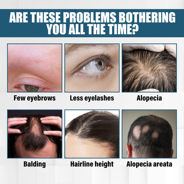 Hair Essence Spray, Prevent Hair Loss Repair Hair Dry And Frizzy Moisture And Dense Hair Essence